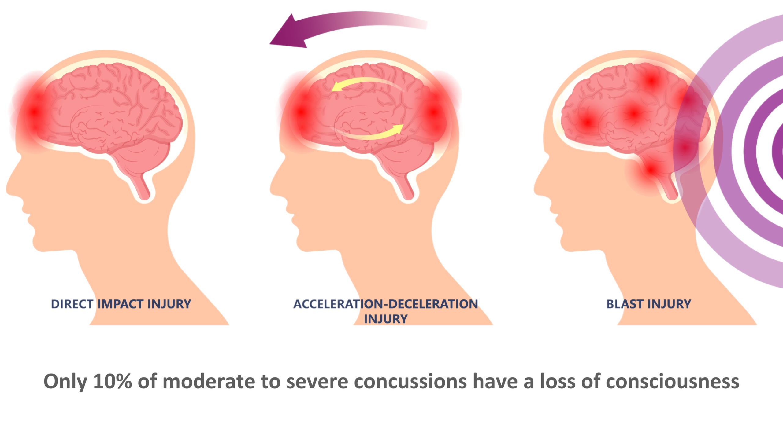 Concussion Center